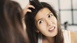 How to Get Rid of Dandruff Naturally at Home